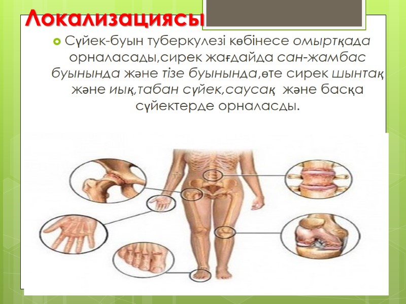 Локализациясы Сүйек-буын туберкулезі көбінесе омыртқада орналасады,сирек жағдайда сан-жамбас буынында және тізе буынында,өте сирек шынтақ
